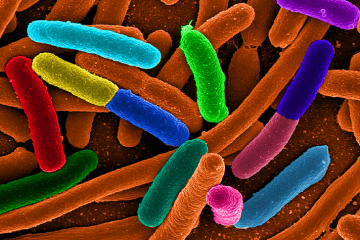 Diverse_e_Coli